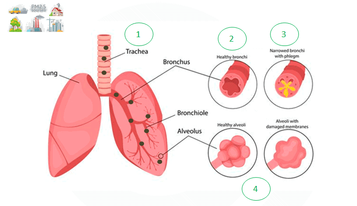Can Fine Particulate Matter induce heart-related conditions?